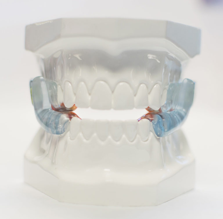 Types of Oral Appliances New Jersey Sleep Apnea Solutions