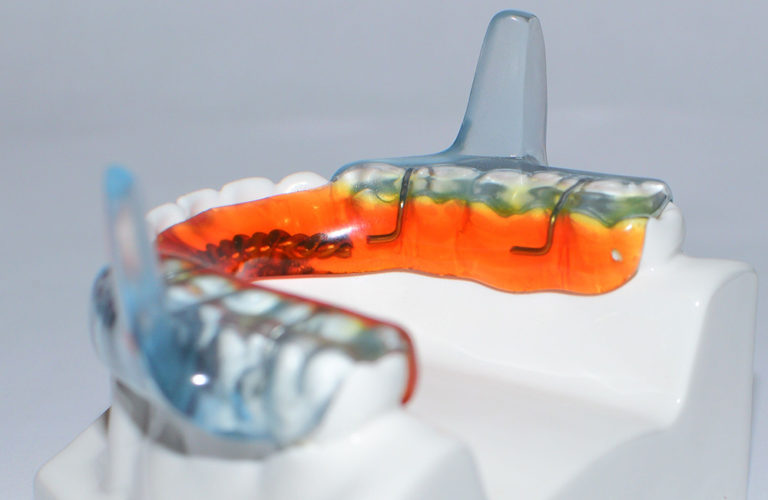 Types of Oral Appliances New Jersey Sleep Apnea Solutions