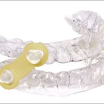 ema oral appliance new jersey